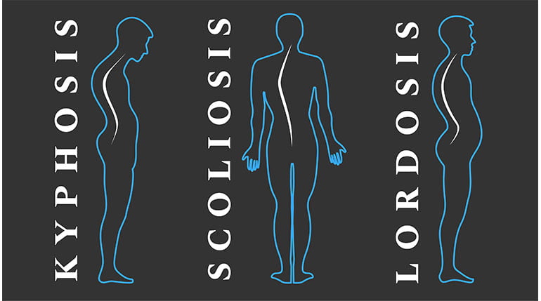 odcinek szyjny kręgosłupa